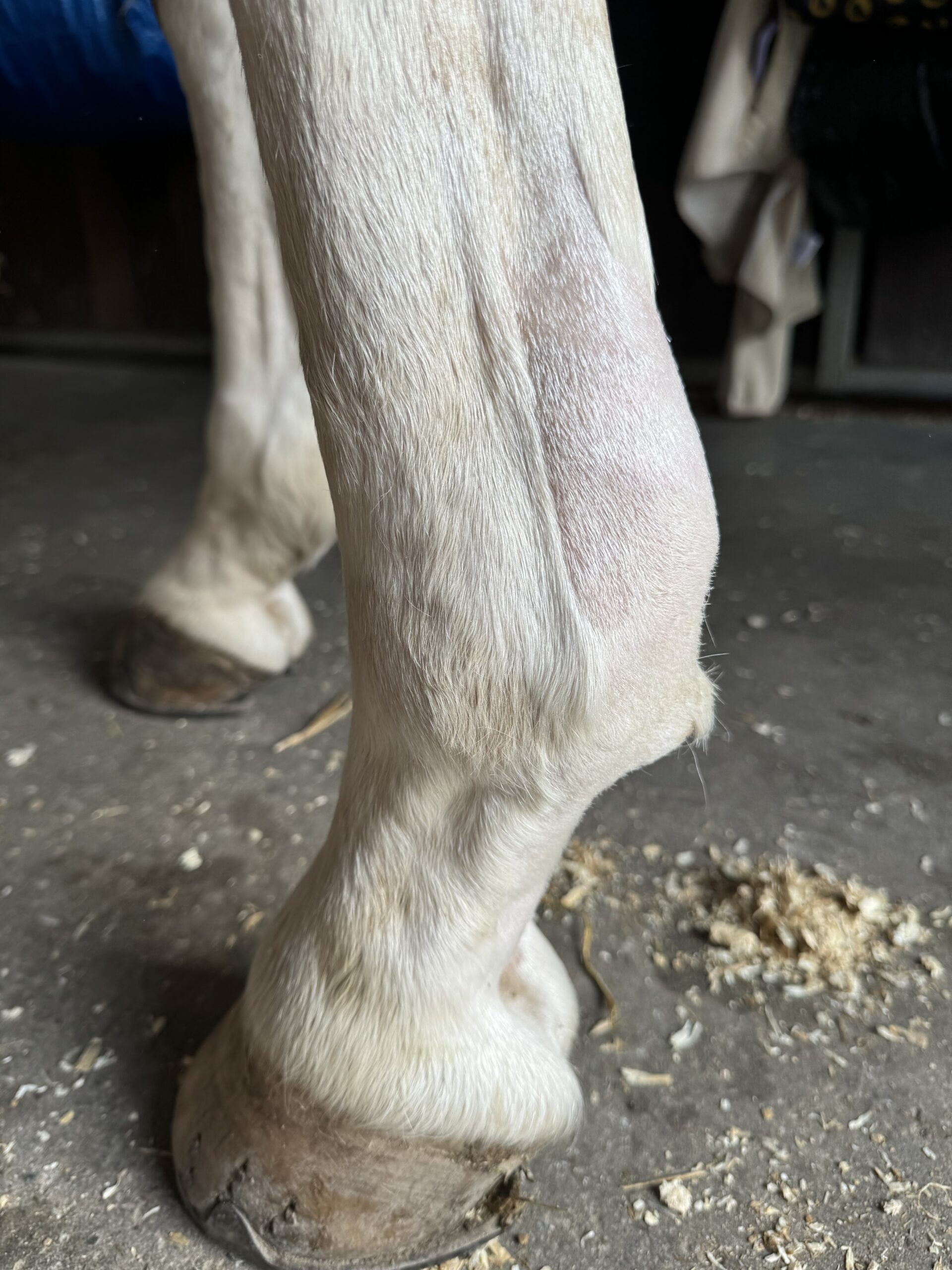 Tidligere skader – som her - i den overfladiske bøjesene, kan medføre tab af elasticitet og forøget risiko for nye skader. Dette er et sådant tilfælde af fornyet skade. Seneskader heler meget langsomt, bl.a. på grund af en relativt begrænset blodtilførsel dertil. Dette, sammenholdt med risikoen for fornyet skade, kan gøre støtte, såvel som forebyggelse særligt vigtigt.